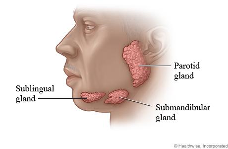 Xerostomia (salivary glands)