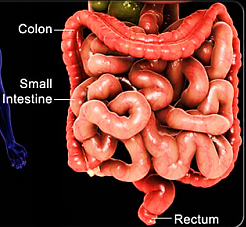 Pancolitis (intestine)