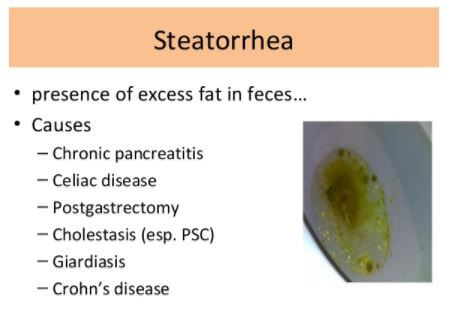 Steatorrhea images definition